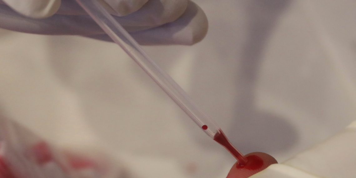 Aumento en casos VIH coloca a Chiapas en cuarto lugar nacional