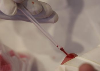 Aumento en casos VIH coloca a Chiapas en cuarto lugar nacional